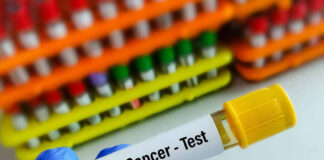 Gloved hand holding colon cancer test tube